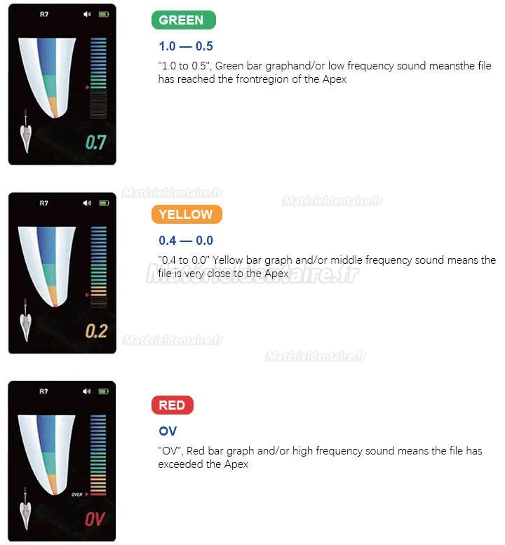 Localisateur d'apex dentaire R7 Mini avec règle endodontique